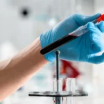 Best Lab For Liver Function Test In Mira Road