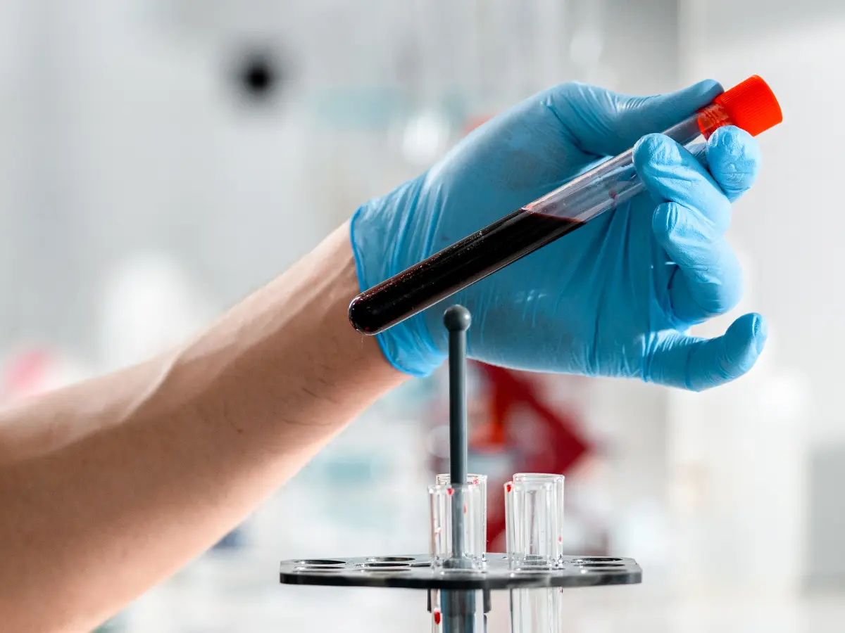 Best Lab For Liver Function Test In Mira Road