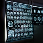 Diagnostic CT Scan In Mira Road