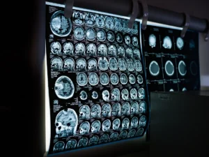 Diagnostic CT Scan In Mira Road