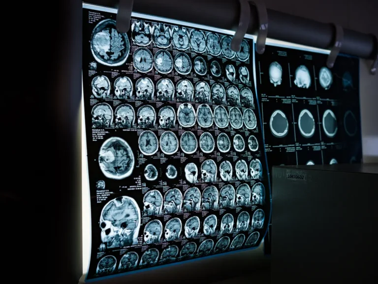 Diagnostic CT Scan In Mira Road