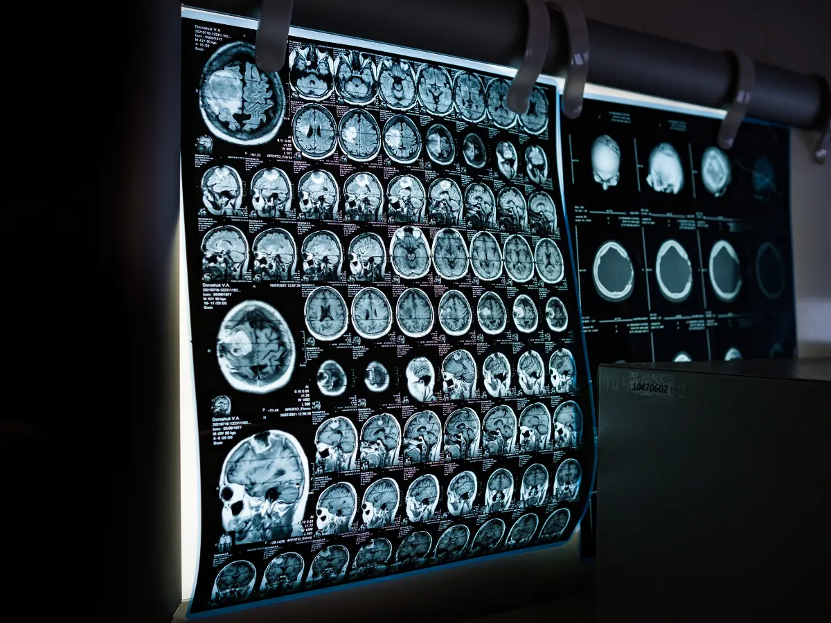 Diagnostic CT Scan In Mira Road